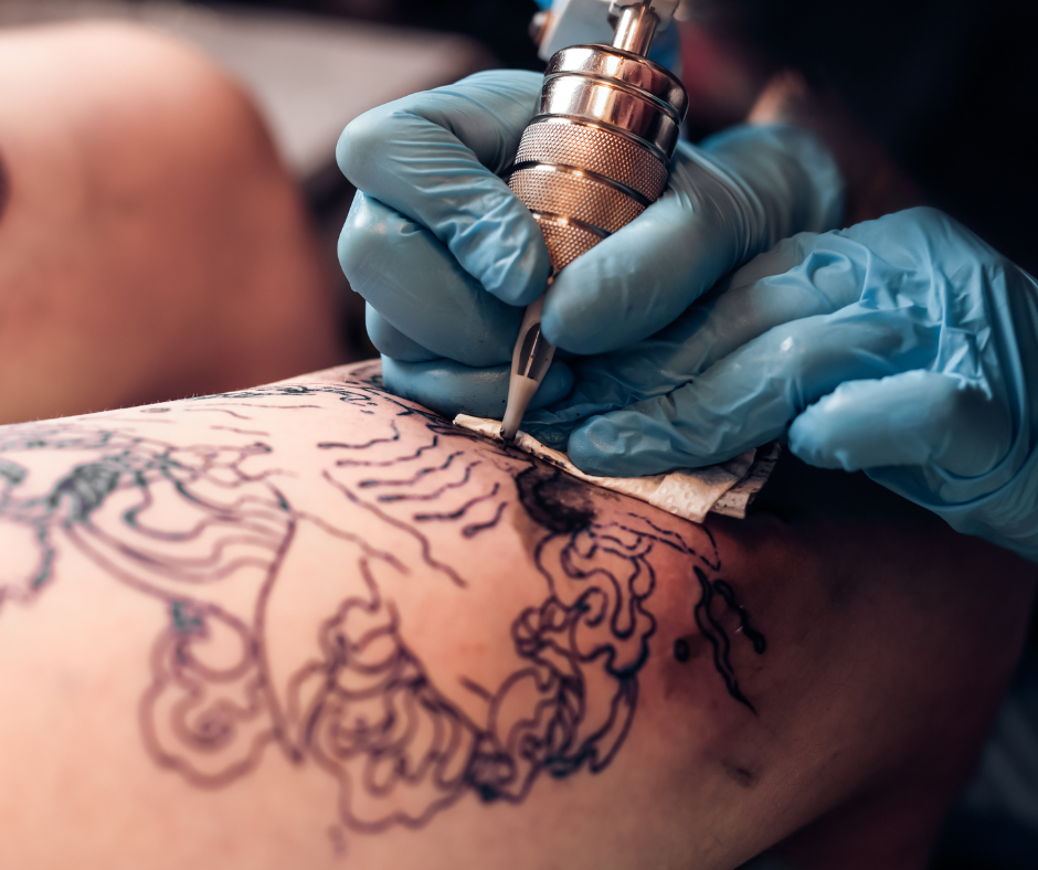 eliminar tatuajes en Alcorcón